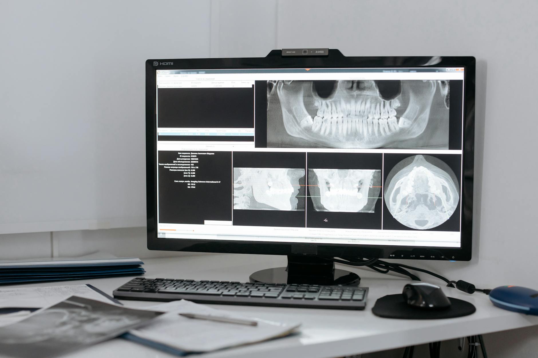 The HIPAA Gap Most Anderson Township Dental Practices Aren’t Tracking