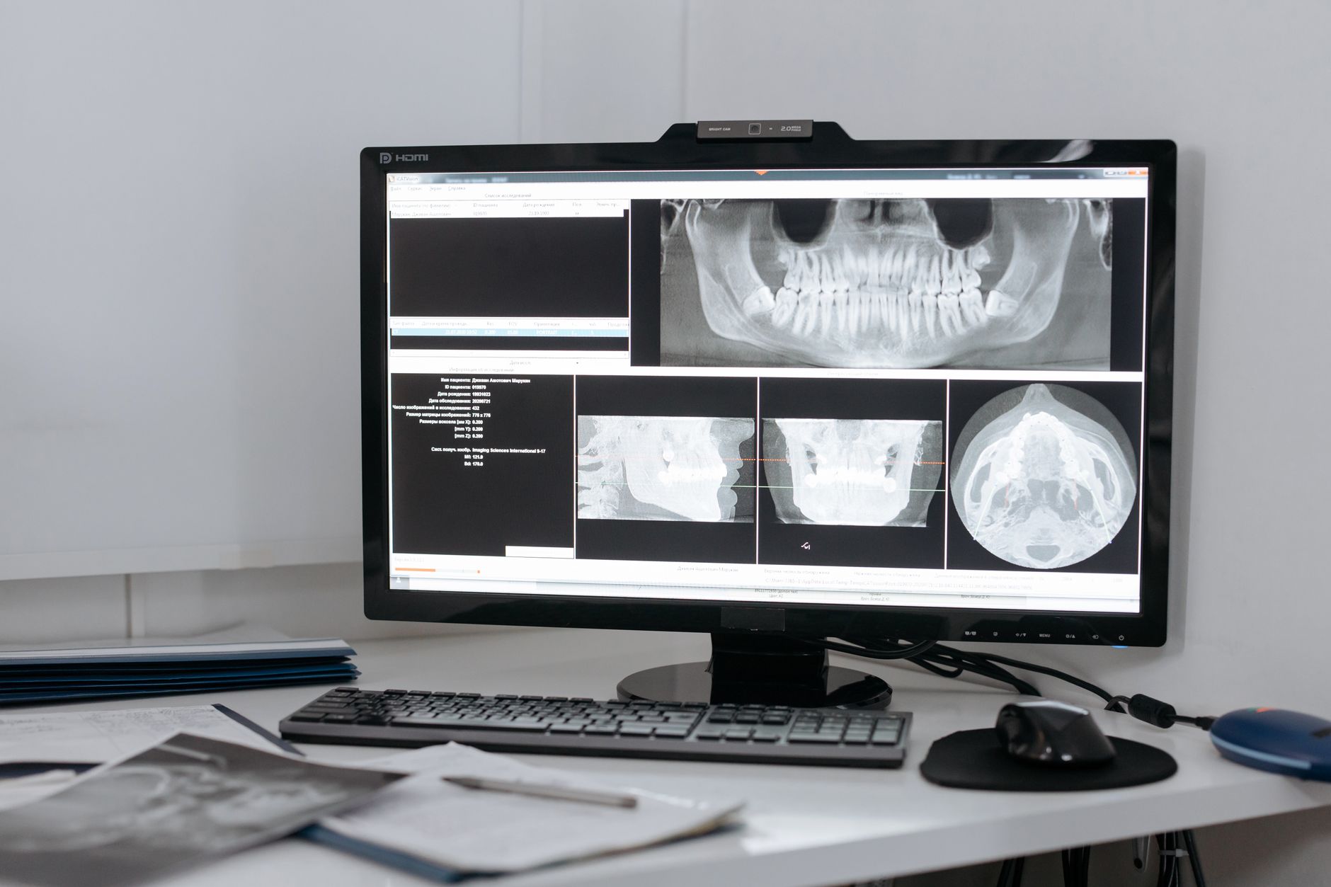 The Imaging Workstation Problem in Burlington KY Dental IT